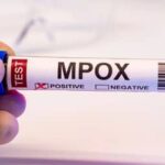 Mpox: Brasil registra 88 casos em seis estados e no DF em 2026; saiba mais sobre a doença