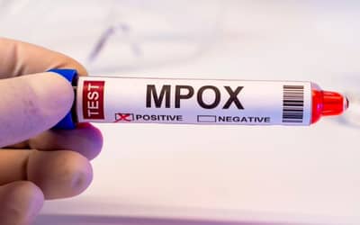 Mpox: Brasil registra 88 casos em seis estados e no DF em 2026; saiba mais sobre a doença